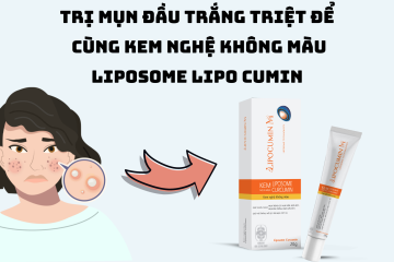 Trị mụn đầu trắng triệt để cùng Kem nghệ không màu Liposome LIPOCUMIN