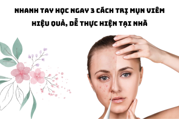 Nhanh tay học ngay 3 cách trị mụn viêm hiệu quả, dễ thực hiện tại nhà