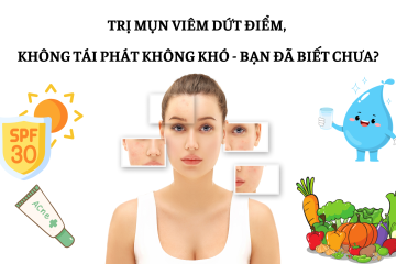 Trị mụn viêm dứt điểm, không tái phát không khó – Bạn đã biết chưa?