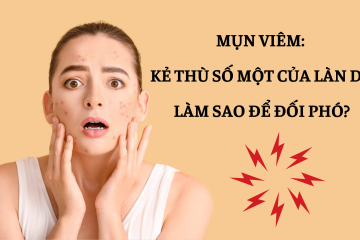 Mụn viêm: Kẻ thù số một của làn da, làm sao để đối phó?