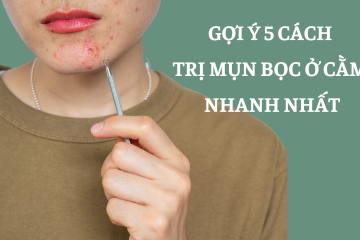 Gợi ý 5 cách trị mụn bọc ở cằm nhanh nhất