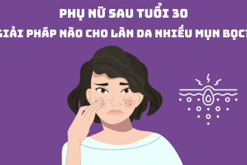 Phụ nữ sau tuổi 30: Giải pháp nào cho làn da nhiều mụn bọc?