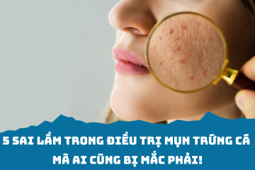 5 sai lầm trong điều trị mụn trứng cá mà ai cũng bị mắc phải!