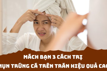Mách bạn 3 cách trị mụn trứng cá trên trán hiệu quả cao, cực an toàn
