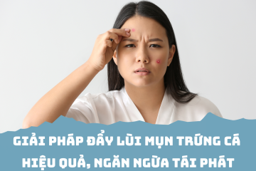 Giải pháp ưu việt giúp người bị mụn trứng cá đẩy lùi mụn hiệu quả, ngăn ngừa tái phát