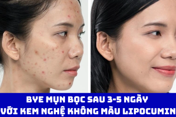 Bye mụn bọc sau 3-5 ngày với kem nghệ không màu LIPOCUMIN