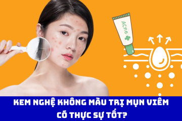 Kem nghệ không màu trị mụn viêm có thực sự tốt?